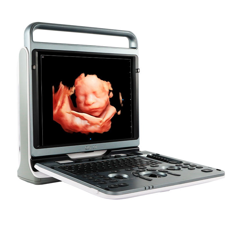 Chison Ebit Ultrasound Ihbhealthcare