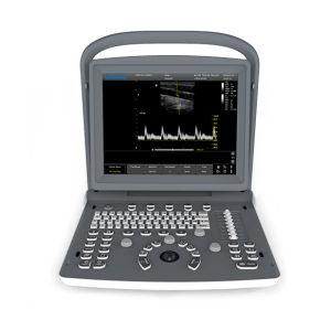 CHISON ECO 2 PORTABLE ULTRASOUND