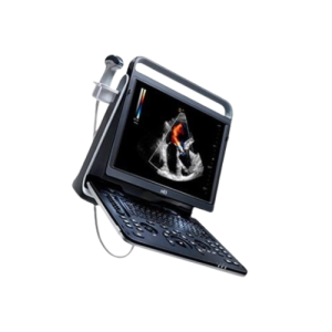 CHISON EBIT 50 ULTRASOUND